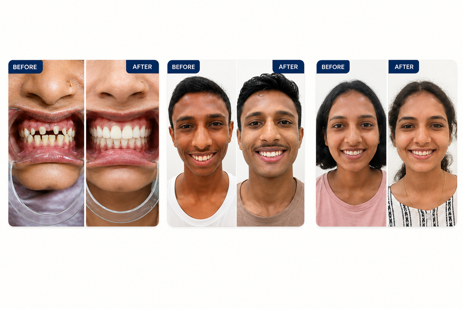 Cosmetic & orthodontic outcomes